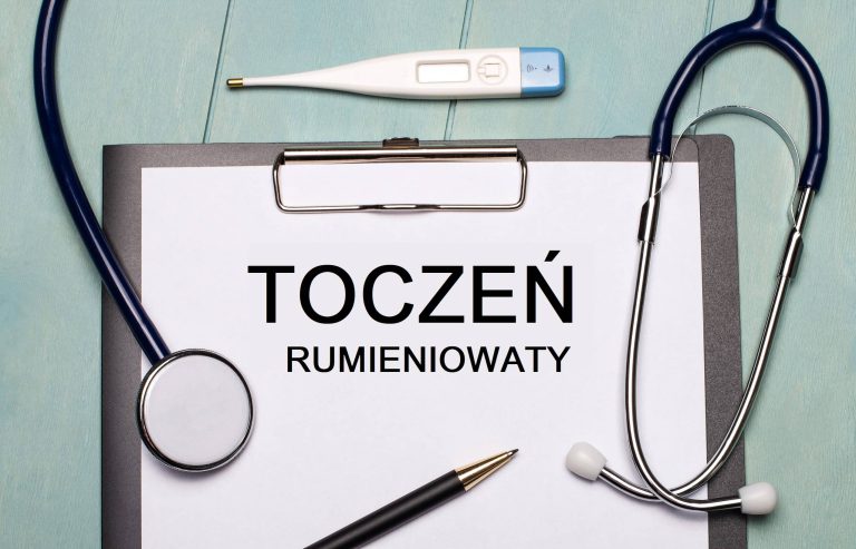 toczeń rumieniowaty