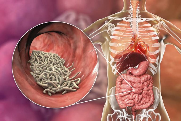 Askarioza (glistnica) objawy, które należy rozpoznać i jak ją leczyć