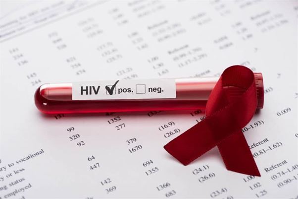 Wirus HIV- jakich sytuacji unikać, by się nie zarazić